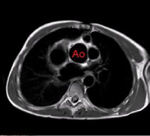 Curso de últimos avances en resonancia magnética cardiaca y de grandes vasos