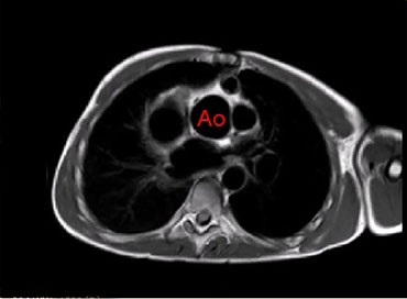 Curso de últimos avances en resonancia magnética cardiaca y de grandes vasos