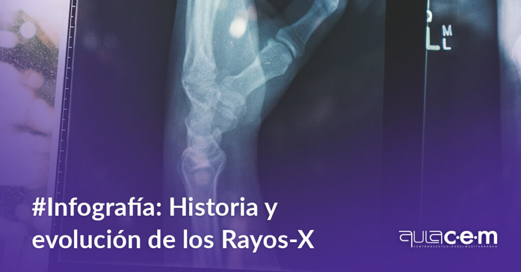 En la siguiente infografía encontrarnos un breve recorrido por la historia de los Rayos-x.