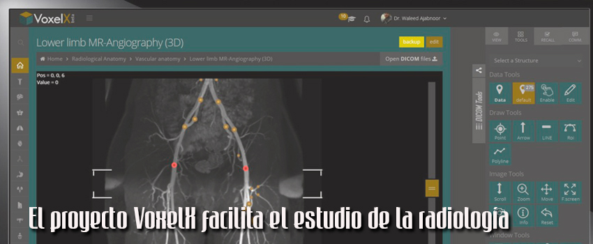 El proyecto VoxelX facilita el estudio de la radiología